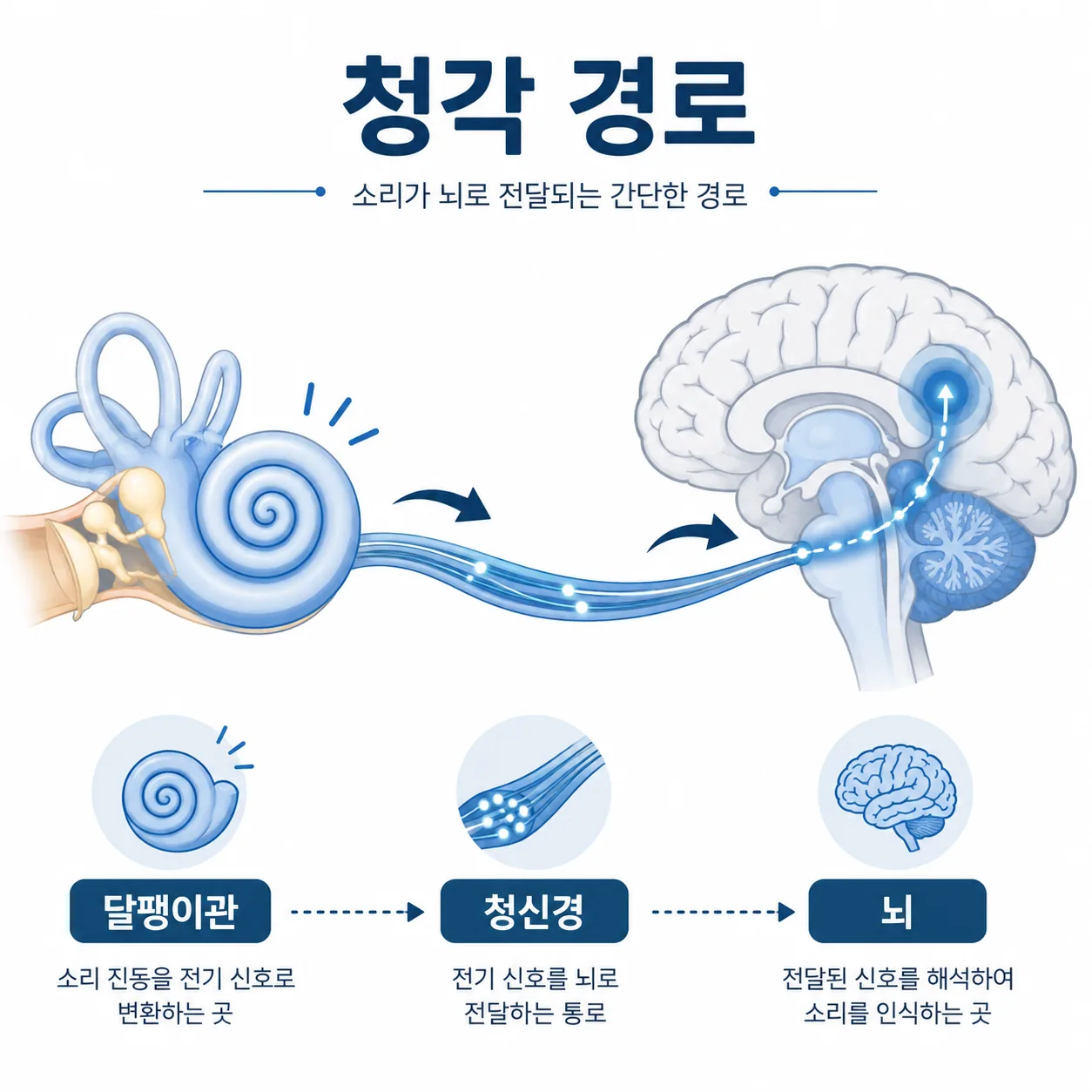 청각 신호가 줄면 뇌가 비정상 신경 반응을 내어 이명이 생기는 경로 도해