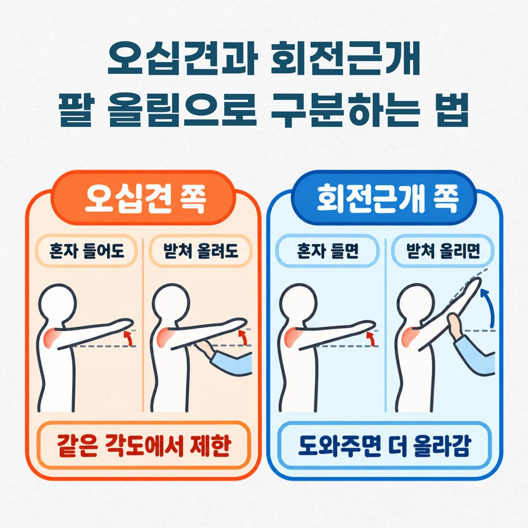 오십견과 회전근개 질환을 가르는 능동 거상과 수동 거상 비교 개념도