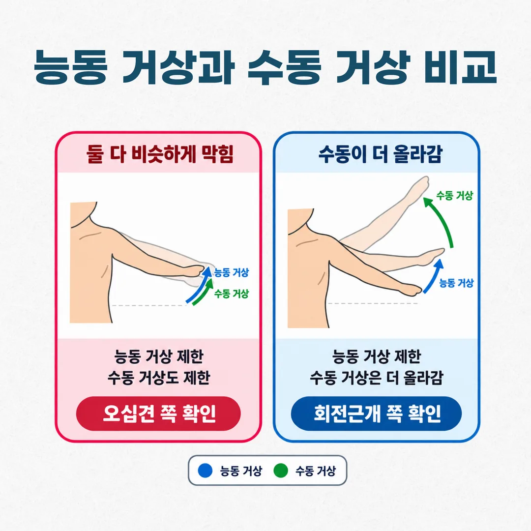 능동 거상은 막히고 수동 거상은 더 올라가는 경우와 둘 다 같은 각도에서 막히는 경우를 비교한 그림