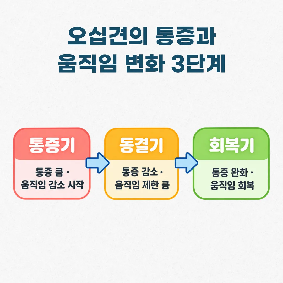 오십견 경과 세 시기별 통증과 운동범위 변화를 나타낸 도식
