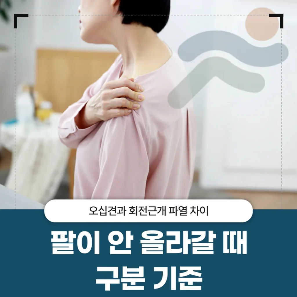 오십견과 회전근개 파열 차이 — 팔이 안 올라갈 때 구분 기준