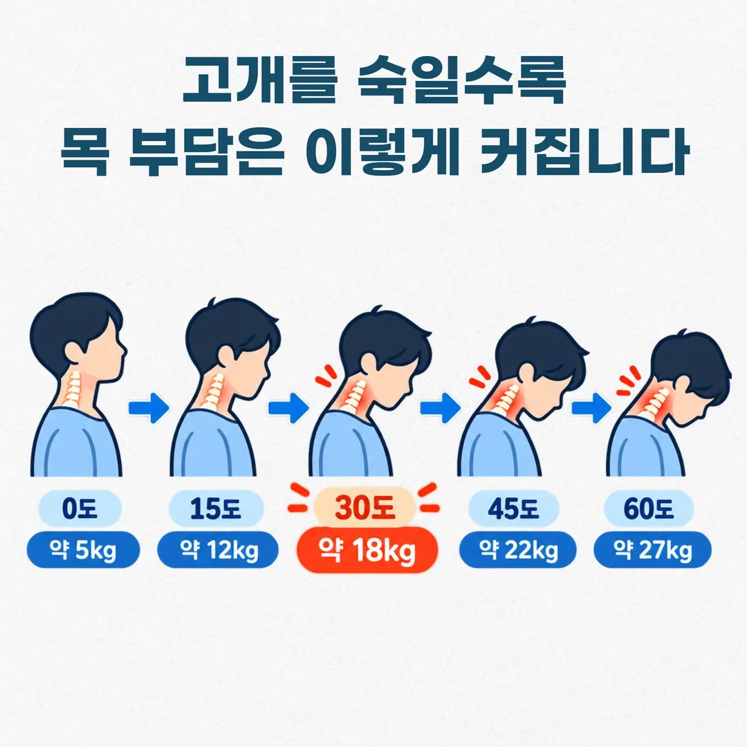 고개 숙임 각도별로 목에 실리는 하중이 커지는 과정을 단계별로 나타낸 도해