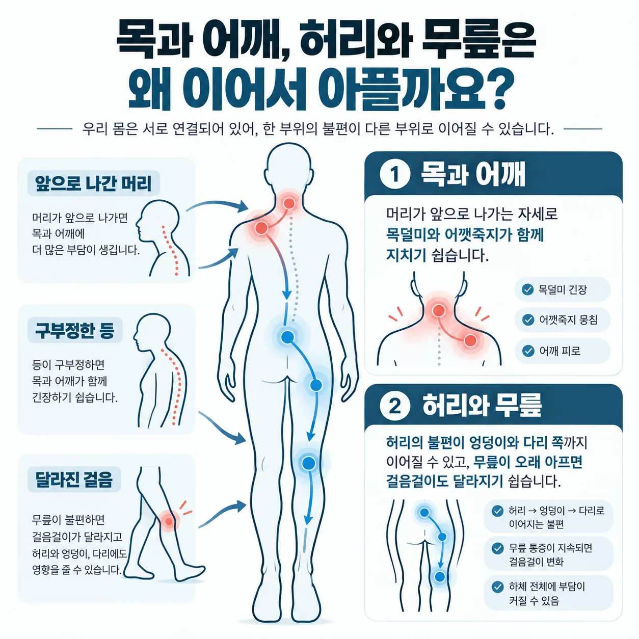목과 어깨, 허리와 무릎이 자세와 걸음으로 이어져 함께 아플 수 있음을 보여 주는 개념도