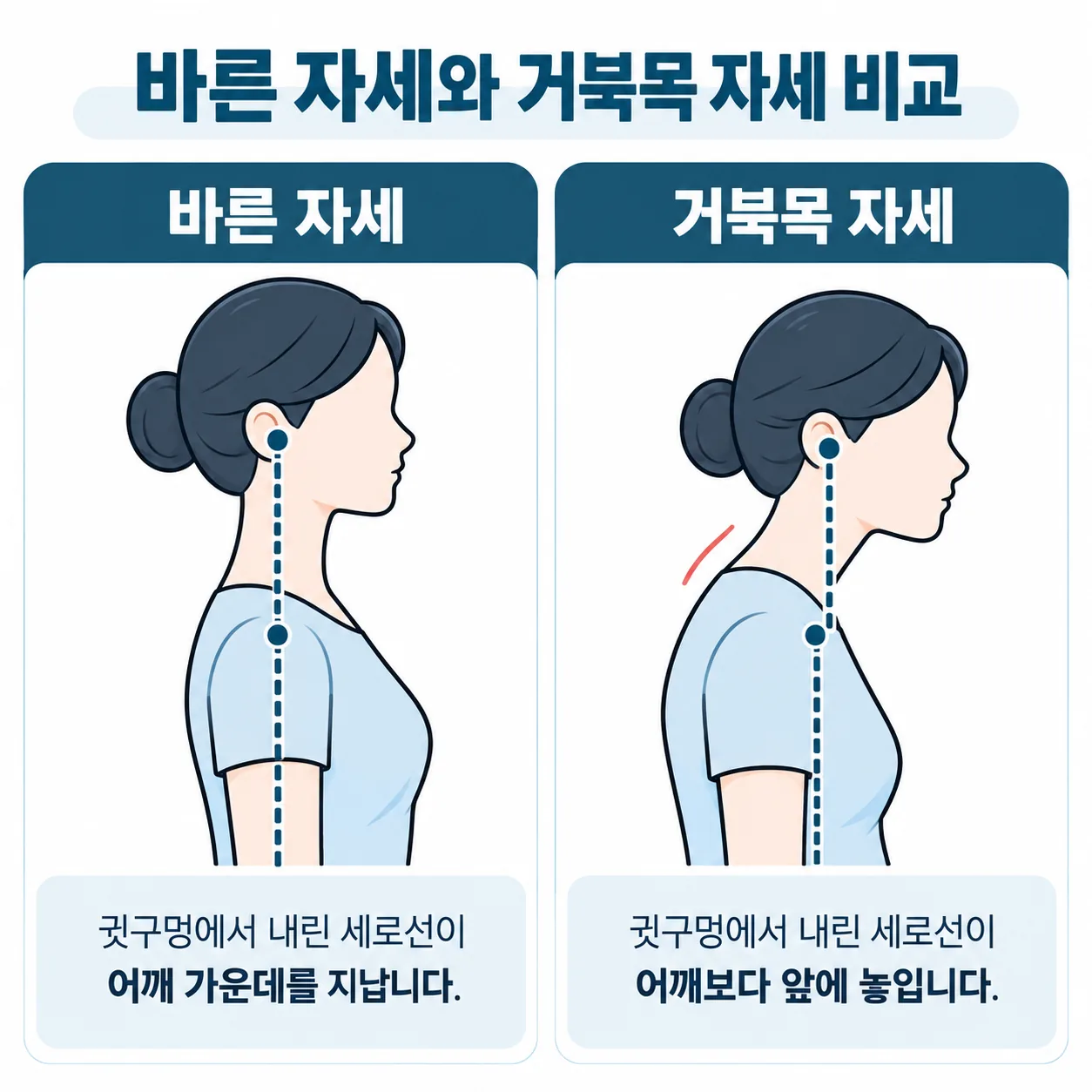 귓구멍에서 내린 세로선과 어깨 가운데의 위치로 바른 자세와 거북목 자세를 비교한 옆모습 그림