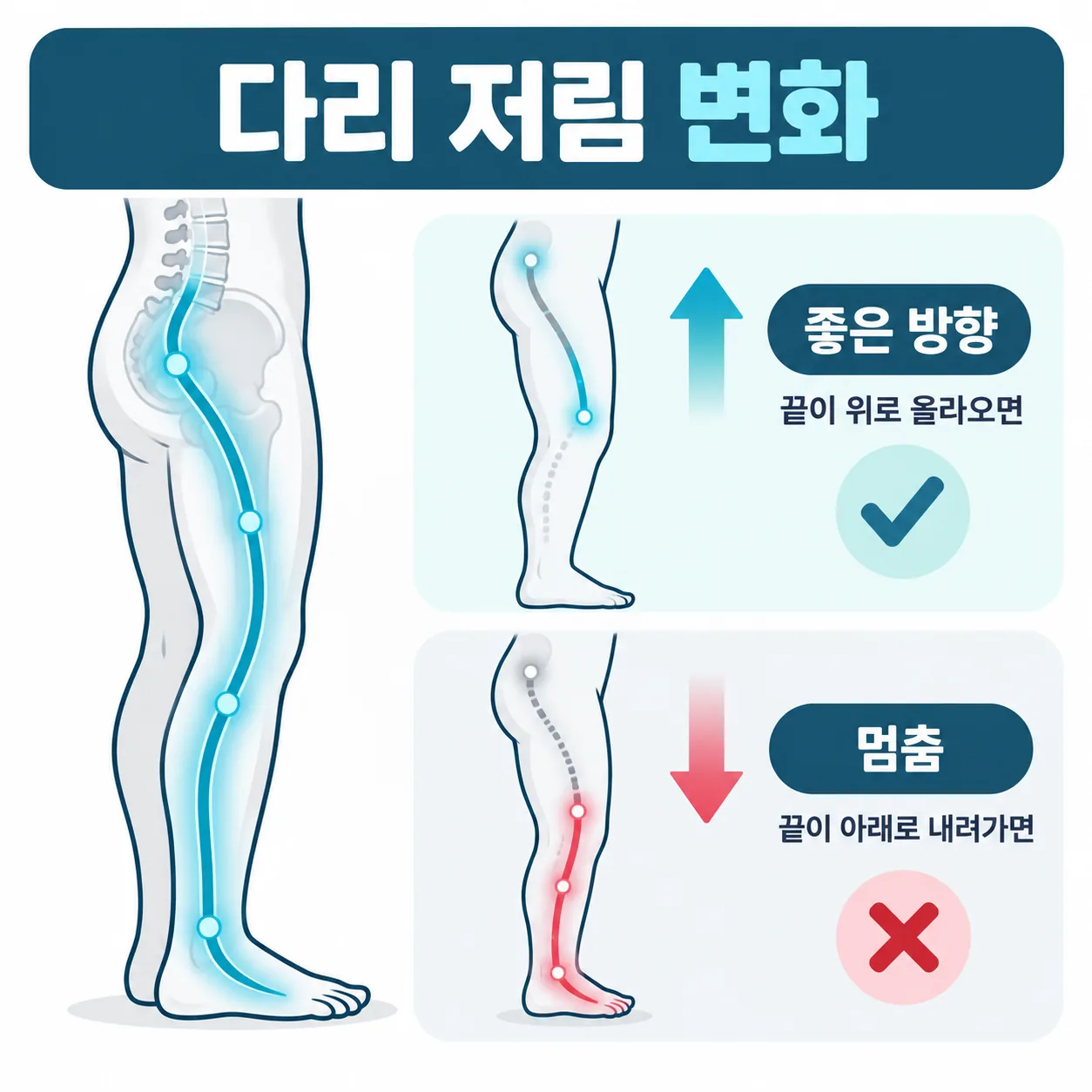 다리 저림의 끝이 위로 올라오면 좋은 방향, 아래로 내려가면 멈춤을 표시한 개념도